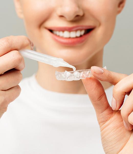 Nose-to-shoulder view of woman applying whitening gel to applicator tray