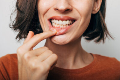 A woman with a concerned expression holds her finger to her mouth, indicating a dental issue related to gum disease.